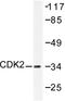 Cyclin Dependent Kinase 2 antibody, AP06046PU-N, Origene, Western Blot image 