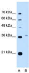 Peroxisomal biogenesis factor 3 antibody, TA339260, Origene, Western Blot image 