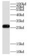 COMM Domain Containing 5 antibody, FNab01851, FineTest, Western Blot image 