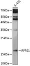 Ribonuclease P/MRP Subunit P21 antibody, 15-532, ProSci, Western Blot image 