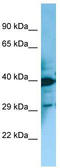 Melanin Concentrating Hormone Receptor 2 antibody, TA342915, Origene, Western Blot image 