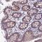 Coiled-Coil Domain Containing 191 antibody, NBP1-94189, Novus Biologicals, Immunohistochemistry paraffin image 