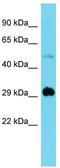 MAX Interactor 1, Dimerization Protein antibody, TA341741, Origene, Western Blot image 