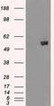 AKT Serine/Threonine Kinase 2 antibody, CF500783, Origene, Western Blot image 