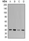 Uroporphyrinogen decarboxylase antibody, orb340928, Biorbyt, Western Blot image 