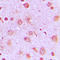 Phosphofructokinase, Platelet antibody, LS-C352652, Lifespan Biosciences, Immunohistochemistry frozen image 