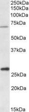 Carnitine O-palmitoyltransferase 2, mitochondrial antibody, TA311116, Origene, Western Blot image 