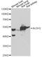 Aldehyde Dehydrogenase 2 Family Member antibody, A13463, ABclonal Technology, Western Blot image 