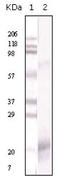 Interferon Gamma antibody, AM20853PU-N, Origene, Western Blot image 