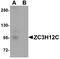 Probable ribonuclease ZC3H12C antibody, A13406, Boster Biological Technology, Western Blot image 