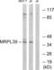 Mitochondrial Ribosomal Protein L39 antibody, LS-C120092, Lifespan Biosciences, Western Blot image 