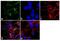 Angiotensin II Receptor Type 2 antibody, PA3-210, Invitrogen Antibodies, Immunofluorescence image 