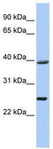 Chromosome 12 Open Reading Frame 42 antibody, TA334995, Origene, Western Blot image 
