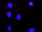 MAP kinase-interacting serine/threonine-protein kinase 2 antibody, H00002872-M07, Novus Biologicals, Proximity Ligation Assay image 