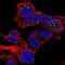 Zinc Finger CCCH-Type Containing 10 antibody, HPA062265, Atlas Antibodies, Immunocytochemistry image 