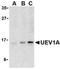 Ubiquitin Conjugating Enzyme E2 V1 antibody, orb109002, Biorbyt, Western Blot image 