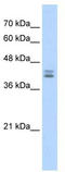 Short transient receptor potential channel 6 antibody, TA341715, Origene, Western Blot image 
