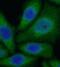 Cytochrome P450 Family 11 Subfamily B Member 2 antibody, FNab02144, FineTest, Immunofluorescence image 