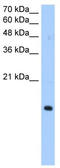 Paired Immunoglobin Like Type 2 Receptor Alpha antibody, TA341919, Origene, Western Blot image 