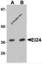 EI24 Autophagy Associated Transmembrane Protein antibody, 6487, ProSci, Western Blot image 