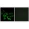 cN1A antibody, A12036, Boster Biological Technology, Immunohistochemistry paraffin image 
