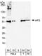 Eukaryotic translation initiation factor 5 antibody, NB100-93312, Novus Biologicals, Western Blot image 