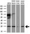 VPS28 Subunit Of ESCRT-I antibody, M06407, Boster Biological Technology, Western Blot image 