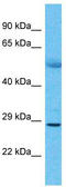 Killer Cell Immunoglobulin Like Receptor, Three Ig Domains And Short Cytoplasmic Tail 1 antibody, TA346472, Origene, Western Blot image 