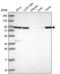 Neuregulin 2 antibody, NBP2-57043, Novus Biologicals, Western Blot image 