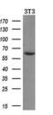 Amylase Alpha 2A (Pancreatic) antibody, GTX84887, GeneTex, Western Blot image 