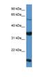 Netrin G2 antibody, orb331096, Biorbyt, Western Blot image 