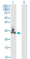 Synaptosome Associated Protein 23 antibody, LS-C133573, Lifespan Biosciences, Western Blot image 