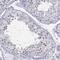 Junctional Cadherin Complex Regulator antibody, HPA077748, Atlas Antibodies, Immunohistochemistry paraffin image 