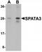 Spermatogenesis Associated 3 antibody, TA320099, Origene, Western Blot image 