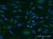 Immunoglobulin superfamily DCC subclass member 4 antibody, H00057722-M05, Novus Biologicals, Immunofluorescence image 
