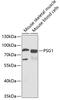 Pregnancy-specific beta-1-glycoprotein 1 antibody, 22-189, ProSci, Western Blot image 