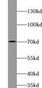 Zinc Finger Protein 460 antibody, FNab09701, FineTest, Western Blot image 