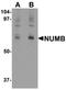 Protein numb homolog antibody, orb95664, Biorbyt, Western Blot image 