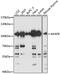 A-Kinase Anchoring Protein 8 antibody, 18-919, ProSci, Western Blot image 