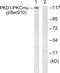 Protein Kinase D1 antibody, PA5-38388, Invitrogen Antibodies, Western Blot image 