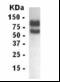 Low Density Lipoprotein Receptor antibody, XW-7339, ProSci, Western Blot image 