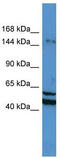 Zinc Finger MYM-Type Containing 3 antibody, TA343504, Origene, Western Blot image 
