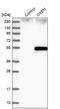 3-Oxoacyl-ACP Synthase, Mitochondrial antibody, NBP1-84731, Novus Biologicals, Western Blot image 