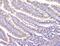 CHM Rab Escort Protein antibody, A00814-2, Boster Biological Technology, Immunohistochemistry paraffin image 