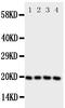 TP antibody, PA1659, Boster Biological Technology, Western Blot image 