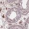 Histone acetyltransferase KAT2A antibody, HPA048958, Atlas Antibodies, Immunohistochemistry frozen image 