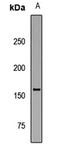 Helicase For Meiosis 1 antibody, LS-C668977, Lifespan Biosciences, Western Blot image 