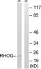 Rho-related GTP-binding protein RhoG antibody, TA313473, Origene, Western Blot image 