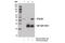 OTU Deubiquitinase With Linear Linkage Specificity antibody, 14127S, Cell Signaling Technology, Immunoprecipitation image 