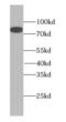 Mdm1 Nuclear Protein antibody, FNab05076, FineTest, Western Blot image 